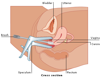 What is a smear test? Why do you need a smear test?